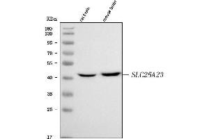 Western blot analysis of SLC25A23 using anti-SLC25A23 antibody (ABIN7600165).