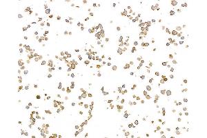 Immunocytochemistry (ICC) image for anti-MHC Class II HLA-DP/DQ/DR (HLA-DP/DQ/DR) antibody (ABIN7449429) (MHC Class II HLA-DP/DQ/DR anticorps)