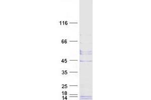 Validation with Western Blot