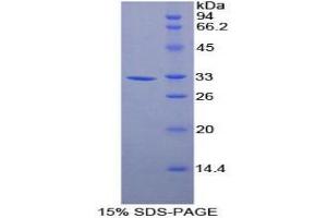 SDS-PAGE analysis of Mouse Annexin A6 Protein. (ANXA6 Protéine)