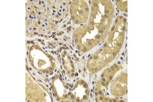 Immunohistochemistry of paraffin-embedded human kidney using SORT1 antibody at dilution of 1:100 (40x lens). (Sortilin 1 anticorps)