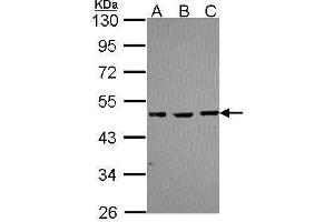 WB Image Sample (30 ug of whole cell lysate) A: A431 , B: JurKat C: Raji 10% SDS PAGE antibody diluted at 1:1000 (MBD2 anticorps  (Center))