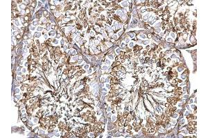 IHC-P Image alpha Tubulin 1A antibody detects alpha Tubulin 1A protein at cytosol on mouse testis by immunohistochemical analysis. (TUBA1A anticorps)
