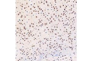 Immunohistochemistry analysis of paraffin-embedded mouse brain using,GTF2F2 (ABIN7074036) at dilution of 1: 3000 (GTF2F2 anticorps)