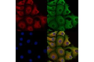 ABIN6258003 and ABIN6273451 staining Hela cells by IF/ICC. (CD5L anticorps  (C-Term))