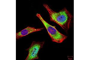 Immunofluorescence analysis of Hela cells using ATG5 mouse mAb (green). (ATG5 anticorps)