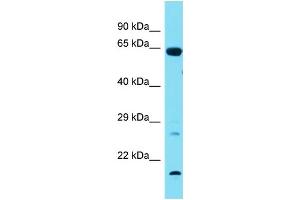 Host:  Rabbit  Target Name:  Tbx18  Sample Type:  Rat Lung lysates  Antibody Dilution:  1. (T-Box 18 anticorps  (N-Term))
