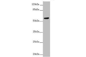 Western blot All lanes: ACVRL1 antibody at 2 μg/mL + MCF-7 whole cell lysate Secondary Goat polyclonal to rabbit IgG at 1/10000 dilution Predicted band size: 57 kDa Observed band size: 57 kDa (ACVRL1 anticorps  (AA 22-118))