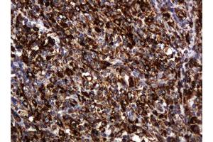 Image no. 14 for anti-Pogo Transposable Element with KRAB Domain (POGK) antibody (ABIN1500329)