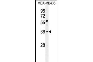 FOXE3 Antibody (Center) (ABIN656110 and ABIN2845450) western blot analysis in MDA-M cell line lysates (35 μg/lane).