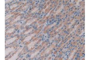 IHC-P analysis of Rat Stomach Tissue, with DAB staining. (ADAP2 anticorps  (AA 49-360))