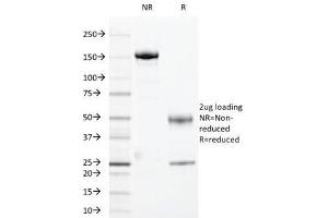 SDS-PAGE Analysis of Purified, BSA-Free HLA-DR Antibody (clone 169-1B5.