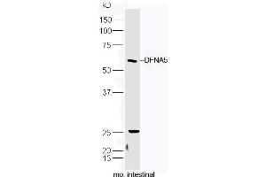 Mouse intestinal lysate probed with Rabbit Anti-DFNA5 Polyclonal Antibody, Unconjugated (ABIN2559452) at 1:300 in 4˚C.