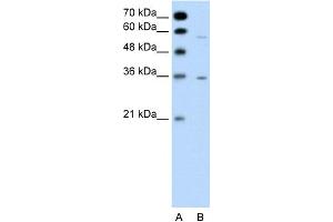 WB Suggested Anti-GPCR5A Antibody Titration:  0. (GPRC5A anticorps  (C-Term))