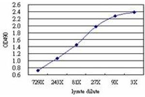 QARS (Human) Matched Antibody Pair