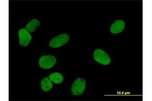 Immunofluorescence of purified MaxPab antibody to PDCD4 on HeLa cell. (PDCD4 anticorps  (AA 1-469))