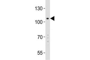 Western blot analysis of K562 lysate and GPR49 antibody at 1:2000.