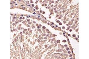 IHC analysis of FFPE mouse testis section using Cyclin B1 antibody; Ab was diluted at 1:25. (Cyclin B1 anticorps  (AA 103-130))