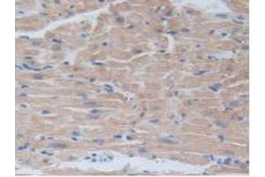IHC-P analysis of Mouse Heart Tissue, with DAB staining. (BRD8 anticorps  (AA 797-951))