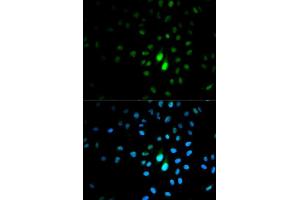 Immunofluorescence analysis of MCF7 cell using PIN1 antibody. (PIN1 anticorps  (AA 1-163))