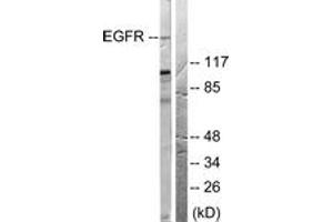 Western blot analysis of extracts from 293 cells, treated with EGF 200ng/ml 30', using EGFR (Ab-678) Antibody. (EGFR anticorps  (AA 651-700))