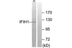 Western Blotting (WB) image for anti-Interferon Induced with Helicase C Domain 1 (IFIH1) (AA 976-1025) antibody (ABIN2889746) (IFIH1 anticorps  (AA 976-1025))
