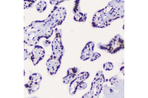 anti-RBBP4 / RbAp48 / NURF55 antibody