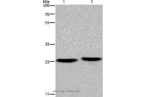 Western blot analysis of Mouse brain and human fetal muscle tissue, using EPDR1 Polyclonal Antibody at dilution of 1:850 (EPDR1 anticorps)