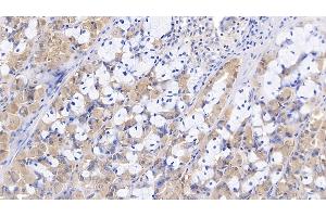 Detection of Slit3 in Porcine Stomach Tissue using Polyclonal Antibody to Slit Homolog 3 (Slit3)