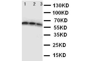 Anti-CD40 antibody, Western blotting Lane 1: Recombinant Human CD40 Protein 10ng Lane 2: Recombinant Human CD40 Protein 5ng Lane 3: Recombinant Human CD40 Protein 2. (CD40 anticorps  (N-Term))