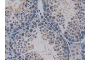 Detection of PDHX in Mouse Testis Tissue using Polyclonal Antibody to Pyruvate Dehydrogenase Complex Component X (PDHX) (PDHX anticorps  (AA 222-471))