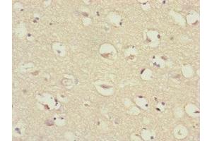 Immunohistochemistry of paraffin-embedded human brain tissue using ABIN7147409 at dilution of 1:100 (CEP57 anticorps  (AA 1-240))