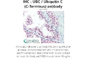 Image no. 1 for anti-Ubiquitin C (UBC) (C-Term) antibody (ABIN2852400)