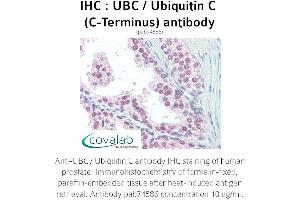 Image no. 1 for anti-Ubiquitin C (UBC) (C-Term) antibody (ABIN2852400) (UBC anticorps  (C-Term))