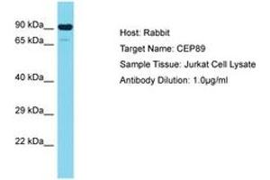 Image no. 1 for anti-Centrosomal Protein 89kDa (CEP89) (AA 41-90) antibody (ABIN6750706) (CEP89 anticorps  (AA 41-90))