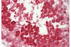 Rabbit Anti-Ubl5 antibody Catalog Number: ARP56285 Formalin Fixed Paraffin Embedded Tissue: Human Testis Primary antibody Concentration: 1:100 Secondary Antibody: Donkey anti-Rabbit-Cy3 Secondary Antibody Concentration: 1:200 Magnification: 20x Exposure Time: 0.