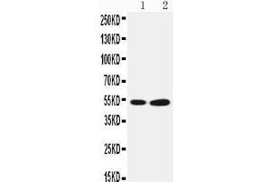 Anti-Selenium Binding Protein 1 antibody, Western blotting Lane 1: COLO320 Cell Lysate Lane 2: PANC Cell Lysate (SELENBP1 anticorps  (Middle Region))