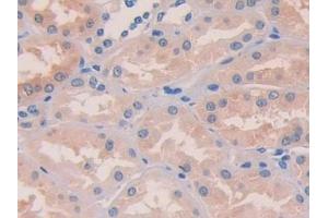 Detection of DHH in Human Kidney Tissue using Polyclonal Antibody to Hedgehog Homolog, Desert (DHH)