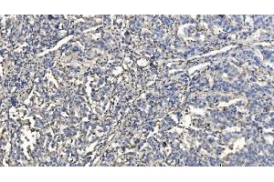 IHC analysis of HYI using anti-HYI antibody (ABIN7601796). (HYI anticorps  (AA 46-277))