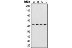 Western blot analysis of NF-kappaB p65 expression in HepG2 (A), MCF7 (B), Raw264. (NF-kB p65 anticorps  (Center))