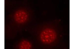 Immunofluorescence analysis of methanol-fixed MCF-7 cells using Phospho-FOXO4(S197) Polyclonal Antibody