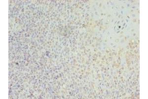 Immunohistochemistry of paraffin-embedded human tonsil tissue using ABIN7158252 at dilution of 1:100 (LILRA2 anticorps  (AA 9-275))