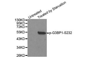Western blot analysis of extracts from 293 cells, using Phospho-G3BP1-S232 antibody.
