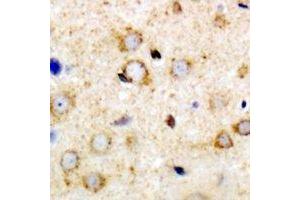 Immunohistochemical analysis of ANR52 staining in mouse brain formalin fixed paraffin embedded tissue section. (ANKRD52 anticorps)
