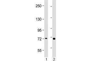 Western blot testing of human 1) placenta and 2) Jurkat lysate with TAP2 antibody at 1:2000.