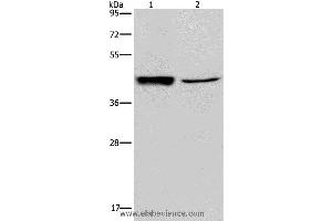 Western blot analysis of Human hepatocellular carcinoma tissue and A549 cell, using GRPR Polyclonal Antibody at dilution of 1:300 (GRPR anticorps)