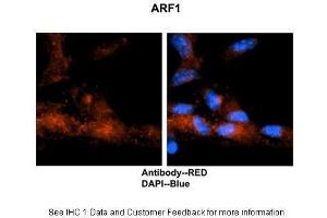 Researcher: Dr. (ARF1 anticorps  (Middle Region))