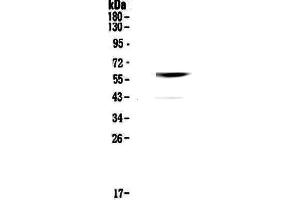 Western blot analysis of Cannabinoid Receptor I using anti-Cannabinoid Receptor I antibody . (CNR1 anticorps  (AA 1-75))