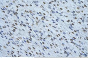 Rabbit Anti-NONO Antibody       Paraffin Embedded Tissue:  Human cardiac cell   Cellular Data:  Epithelial cells of renal tubule  Antibody Concentration:   4. (NONO anticorps  (C-Term))