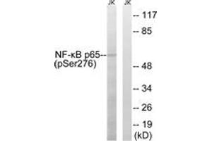 Western blot analysis of extracts from Jurkat cells, using NF-kappaB p65 (Phospho-Ser276) Antibody. (NF-kB p65 anticorps  (pSer276))